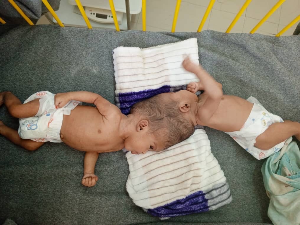 Two girls are born in Tigray